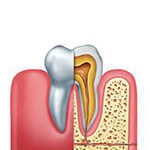 periodontics - dr quesadsa