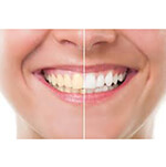 cosmetic dentsitry - dr quesadsa