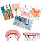 prosthodontics - dr quesadsa